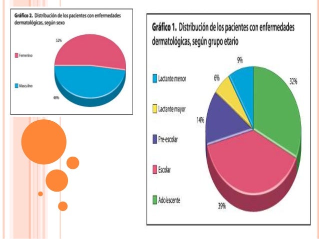 Por qué la eccema solamente sobre una palma