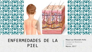 ENFERMEDADES DE LA
PIEL
Maya Luz Alvarado Avila
Unidad de Medicina
Familiar
Marzo, 2017
 