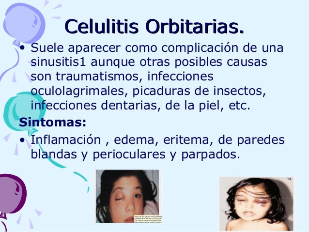 Que más vale curar el hongo de las uñas a buen precio