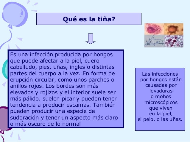 Como librarse del hongo del cuero cabelludo por los medios públicos