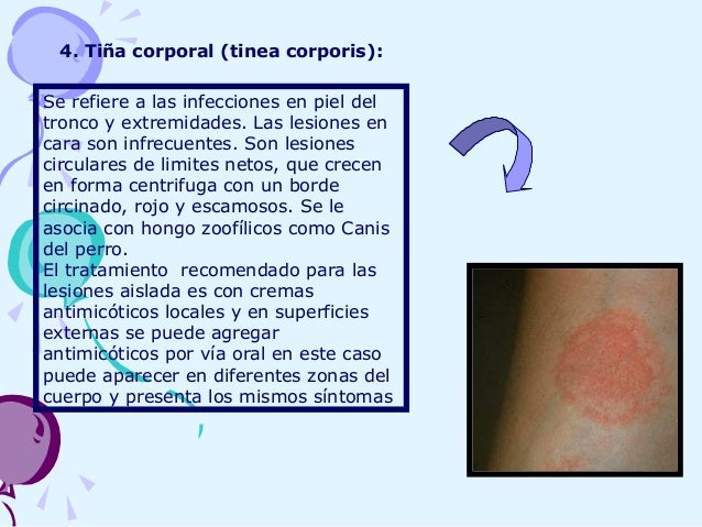 La psoriasis el tratamiento por los medios públicos la psoriasis