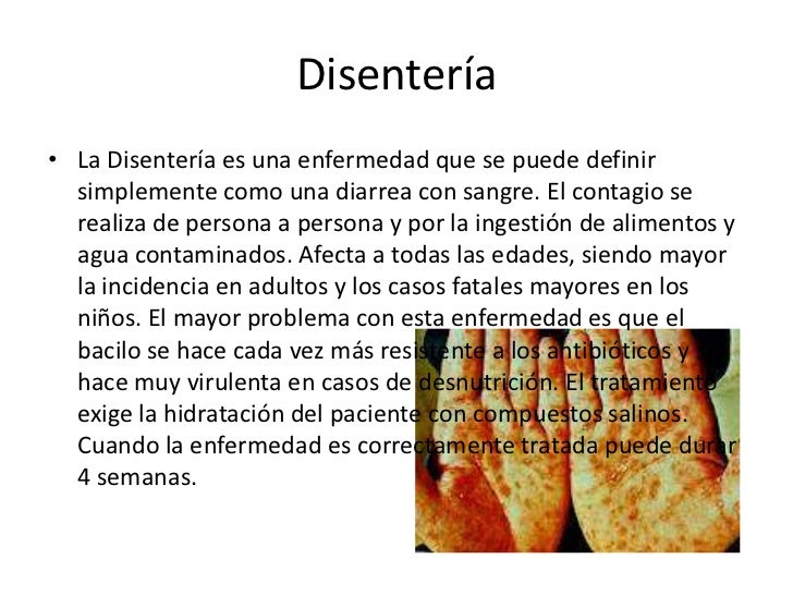 Como comprender que al perrito las lombrices