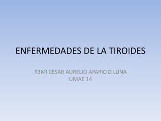 ENFERMEDADES DE LA TIROIDES
R3MI CESAR AURELIO APARICIO LUNA
UMAE 14
 