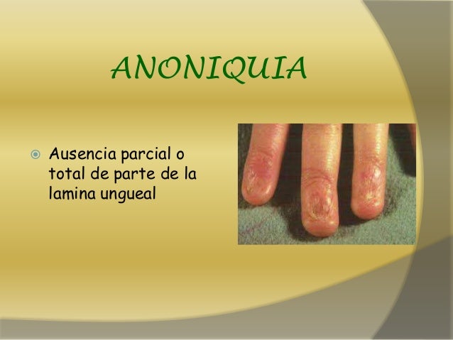El dermatólogo del tratamiento del hongo del pies