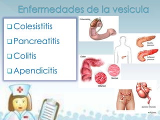  Colesistitis

 Pancreatitis

 Colitis

 Apendicitis
 