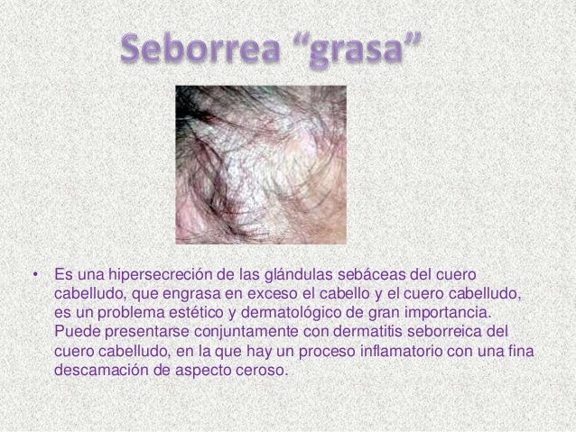 Los aceites para los cabellos del indio las revocaciones