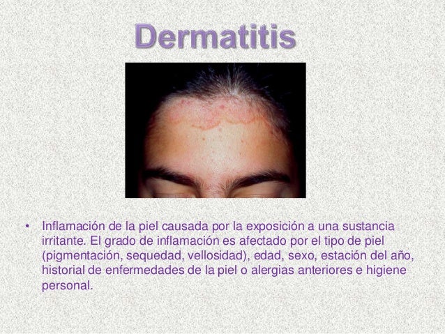 La caída de los cabello de por el adelgazamiento