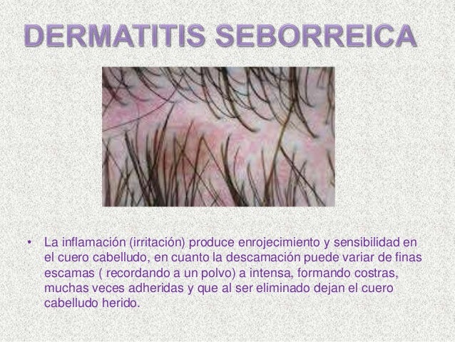 La diagnosis de la psoriasis la dermatología
