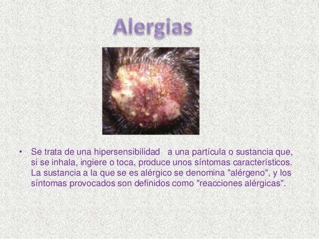 granitos en el cuero cabelludo los tipos de cabello y cuero cabelludo enfermedades del granitos en el cuero cabelludo los tipos de cabello y cuero cabelludo enfermedades del