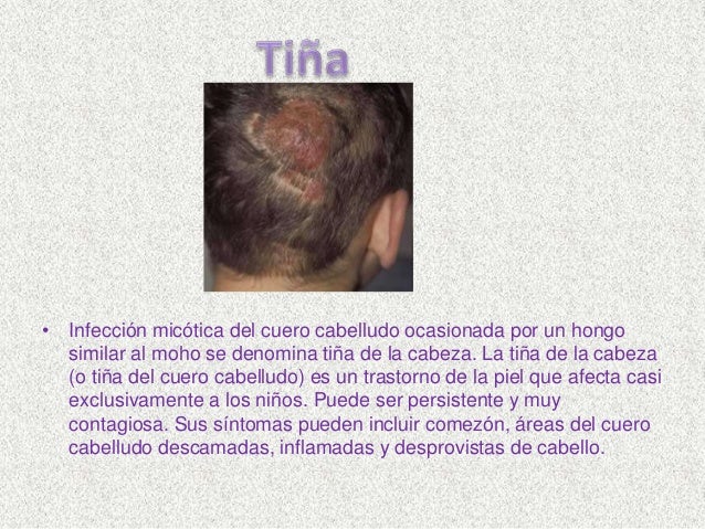 Como sanar el hongo de las uñas en la clínica