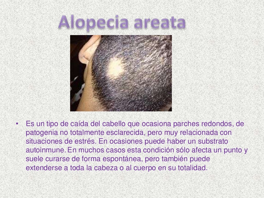 Enfermedades del cuero cabelludo y fibra capilar