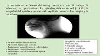 Enfermedades del esofago | PPTX