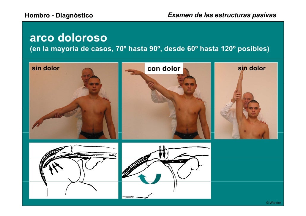 Enfermedades del hombro y pruebas diagnósticas wander
