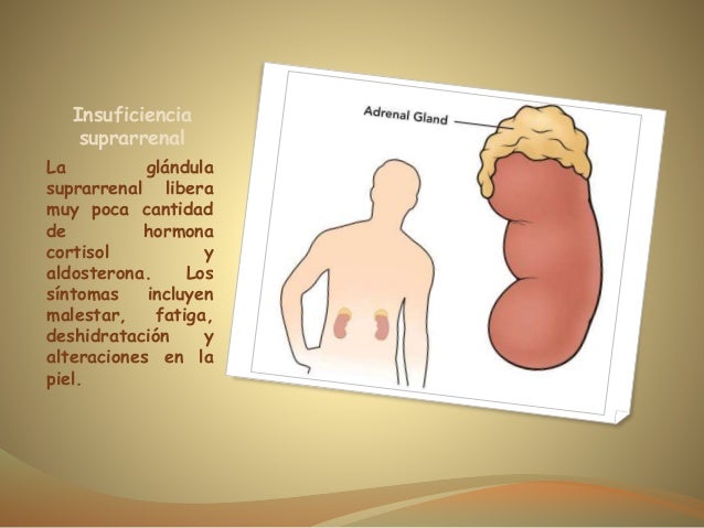 Enfermedades del sistema endocrino