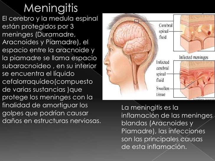 Enfermedades del Sistema Nervioso Grupo 8 Enfermedades del Sistema Nervioso Grupo 8