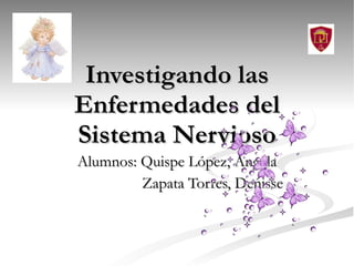 Investigando las Enfermedades del Sistema Nervioso Alumnos: Quispe López, Angela Zapata Torres, Denisse 