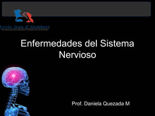 Enfermedades del Sistema
Nervioso
Prof. Daniela Quezada M
 