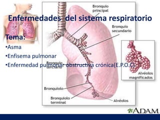 Enfermedades del sistema respiratorio
Tema:
•Asma
•Enfisema pulmonar
•Enfermedad pulmonar obstructiva crónica(E.P.O.C)
 
