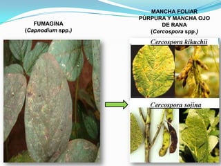 MANCHA FOLIAR PÚRPURA Y MANCHA OJO DE RANA(Cercospora spp.)FUMAGINA(Capnodium spp.)