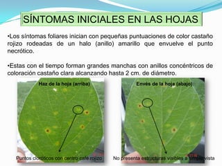 Humedad Relativa por encima del 80%.