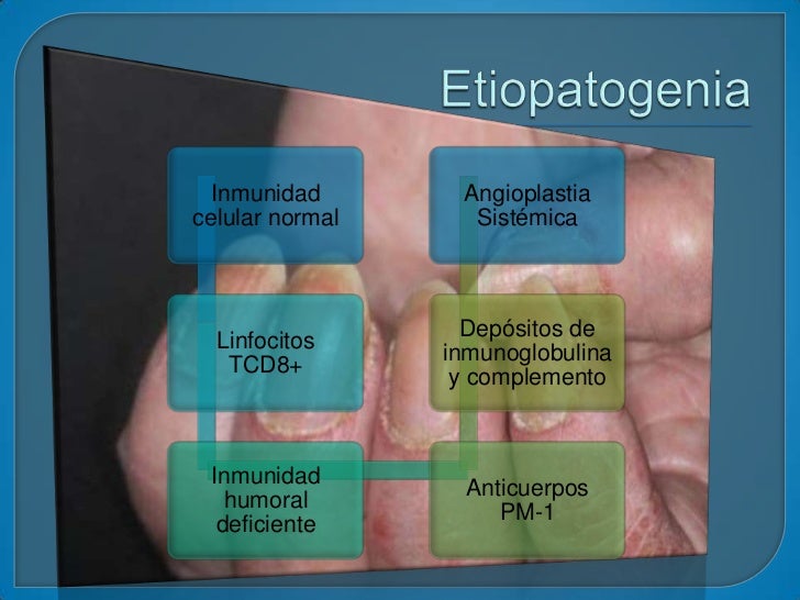 Enfermedades del tejido conectivo (dermatologia) Enfermedades del tejido conectivo (dermatologia)
