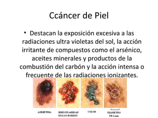 Ccáncer de Piel
• Destacan la exposición excesiva a las
radiaciones ultra violetas del sol, la acción
irritante de compuestos como el arsénico,
aceites minerales y productos de la
combustión del carbón y la acción intensa o
frecuente de las radiaciones ionizantes.
 