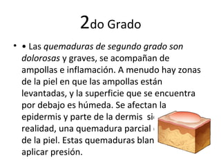 2do Grado
• • Las quemaduras de segundo grado son
dolorosas y graves, se acompañan de
ampollas e inflamación. A menudo hay zonas
de la piel en que las ampollas están
levantadas, y la superficie que se encuentra
por debajo es húmeda. Se afectan la
epidermis y parte de la dermis siendo, en
realidad, una quemadura parcial del espesor
de la piel. Estas quemaduras blanquean al
aplicar presión.
 