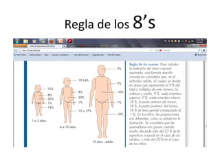 Regla de los 8’s
 