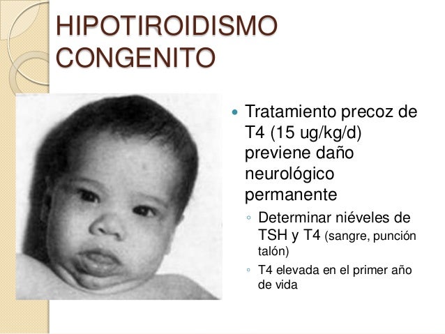 Que hierbas es necesario aceptar el adelgazamiento