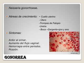 •   Neisseria gonorrhoeae.


   Aéreas de crecimiento: - Cuello uterino
                             - Útero
                             -Trompas de Falopio
                             -Uretra
                             - Boca –Garganta-ojos y ano
   Síntomas:

-   Ardor al orinar.
-   Aumento del flujo vaginal.
-   Hemorragia entre periodos.
-   Picazón.
                                                           cdcnpin.org



GONORREA
 