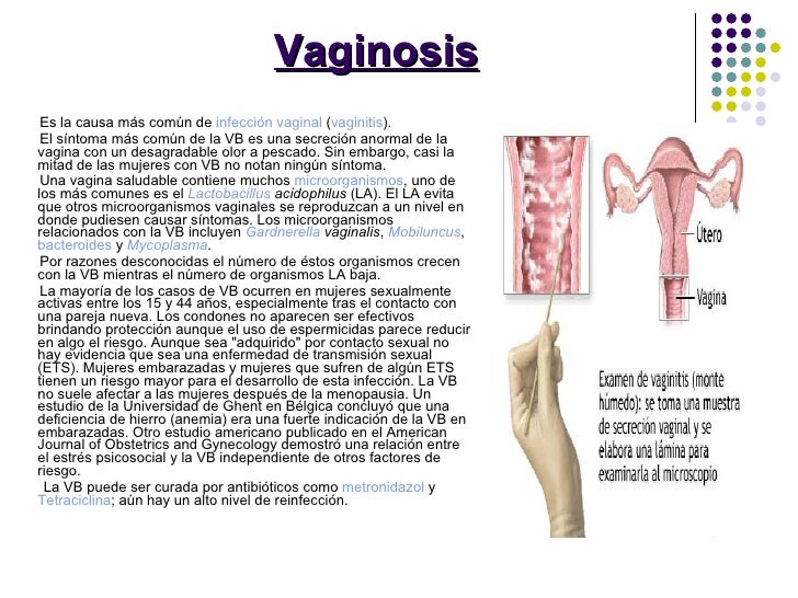Enfermedades De TransmisióN Sexual