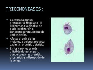 TRICOMONIASIS:Es causada por un protozoario  flagelado (El Trichomana vaginalis), se pude localizar en el conducto genitourinario de ambos sexos.Afecta al 20% de las mujeres, a quienes provoca vaginitis, uretritis y cistitis.En los varones es más difícil de detectar, pero puede causarles uretritis, prostatitis e inflamación de la vejiga. 