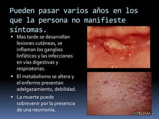 Pueden pasar varios años en los que la persona no manifieste síntomas. Mas tarde se desarrollan lesiones cutáneas, se inflaman los ganglios linfáticos y las infecciones en vías digestivas y respiratorias.El metabolismo se altera y el enfermo presentan adelgazamiento, debilidad.La muerte puede sobrevenir por la presencia de una neumonía. 