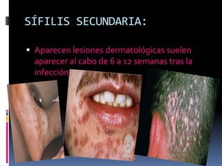 SÍFILIS SECUNDARIA:Aparecen lesiones dermatológicas suelen aparecer al cabo de 6 a 12 semanas tras la infección.