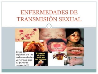 ENFERMEDADES DE
TRANSMISIÓN SEXUAL
 