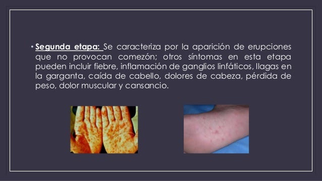 La máscara para los cabellos con la mostaza a la caspa