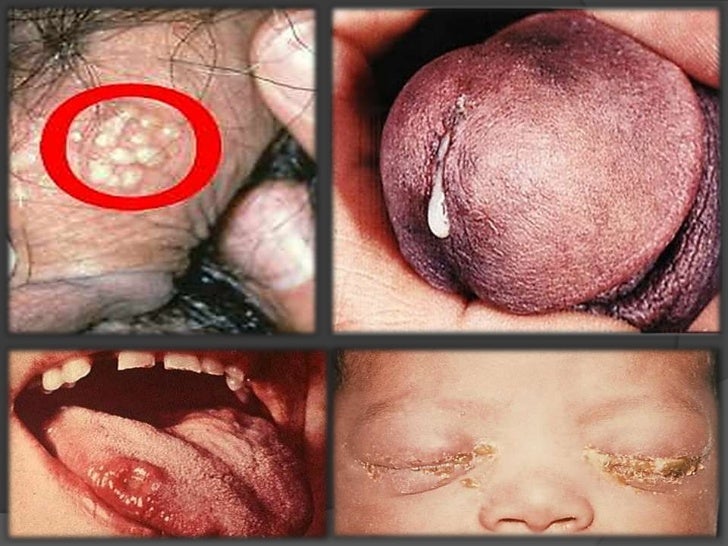 tatuajes guía de acompañantes oral con condón tatuajes guía de acompañantes oral con condón