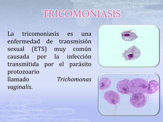 TRICOMONIASIS
La tricomoniasis es una
enfermedad de transmisión
sexual (ETS) muy común
causada por la infección
transmitida por el parásito
protozoario
llamado         Trichomonas
vaginalis.
 