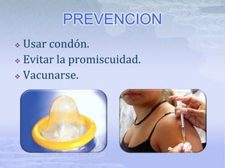 PREVENCION
 Usar condón.
 Evitar la promiscuidad.

 Vacunarse.
 