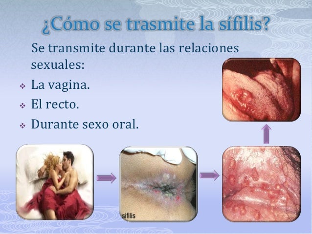 Kifoz sheynogo del departamento de la columna vertebral el masaje