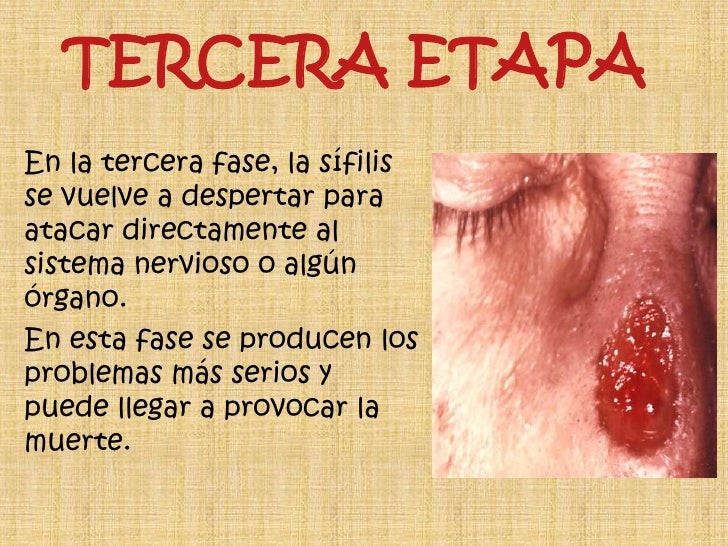 El hongo con levadura a las mujeres de la uña