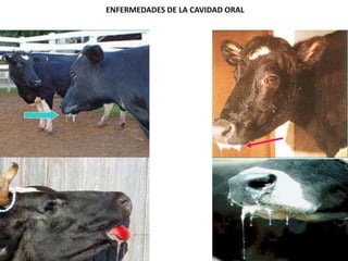 ENFERMEDADES DE LA CAVIDAD ORAL
 