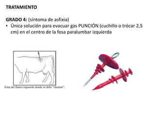 TRATAMIENTO
GRADO 4: (síntoma de asfixia)
• Única solución para evacuar gas PUNCIÓN (cuchillo o trócar 2,5
cm) en el centro de la fosa paralumbar izquierda
 