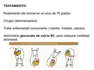 TRATAMIENTO:
Rodamiento del animal en un arco de 70 grados
Cirugía (abomasopexia).
Tratar enfermedad concurrente ( metritis, mastitis, cetosis).
Administrar gluconato de calcio SC, para restaurar motilidad
abomasal.
 