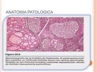 ANATOMIA PATOLOGICA
 