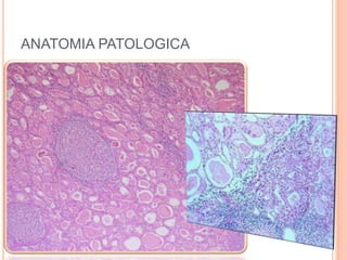 ANATOMIA PATOLOGICA
 