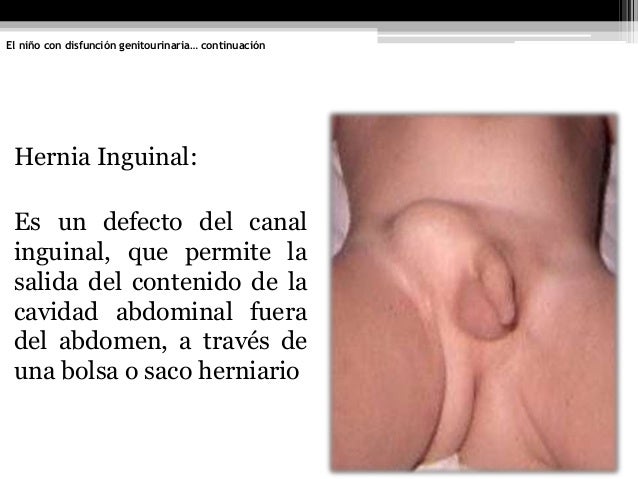 Duele los riñones el vientre está mareado la temperatura que esto puede ser
