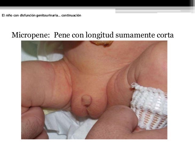 Que pastillas aumentar el miembro