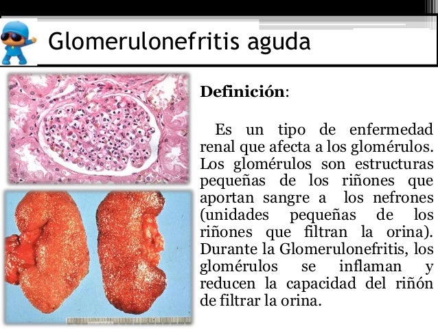 El dolor en los riñones a la derecha dirigirse a que médico