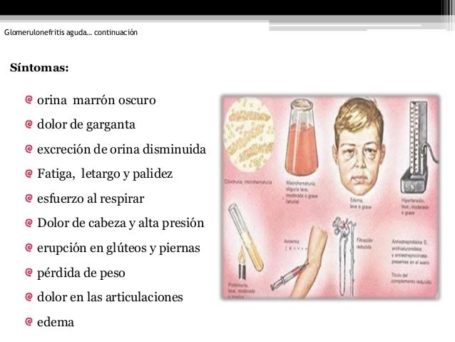 Los dolores en la espalda después de la desaparición de la hernia intervertebral
